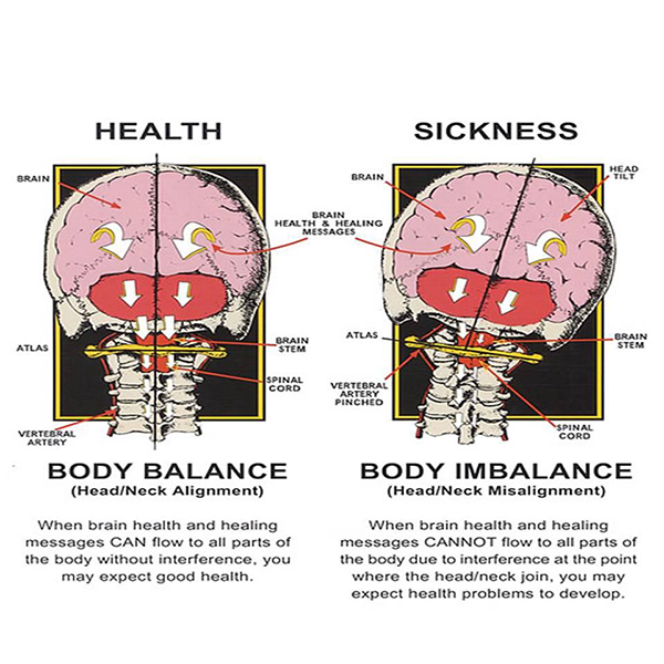 Atlas Vertebra Anatomy Diagram