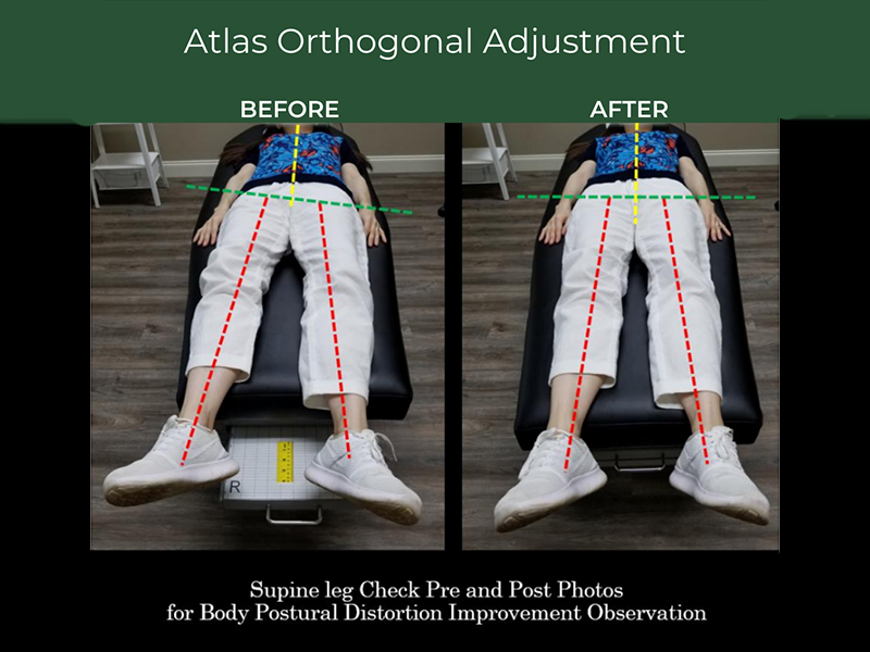 Before and After Posture Improvement with NUCCA Care